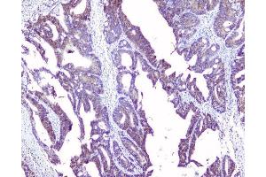 IHC analysis of SRI using anti-SRI antibody (ABIN6719388).