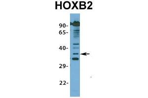 Host:  Rabbit  Target Name:  HOXB2  Sample Type:  Hela  Antibody Dilution:  1.