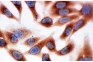 Anti-Calpain 1 antibody, ICC ICC: HELA Cell