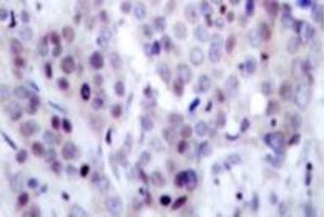 Image no. 2 for anti-Nuclear Factor of kappa Light Polypeptide Gene Enhancer in B-Cells 2 (NFKB2) (pSer869) antibody (ABIN318077)