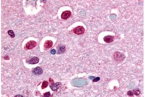 Anti-NR4A3 antibody  ABIN1049142 IHC staining of human brain, neurons and glia. (NR4A3 anticorps  (C-Term))