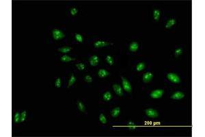 Immunofluorescence of purified MaxPab antibody to D21S2056E on HeLa cell. (RRP1 anticorps  (AA 1-461))