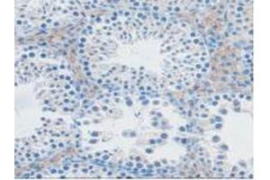 IHC-P analysis of Mouse Testis Tissue, with DAB staining. (NXN anticorps  (AA 167-435))