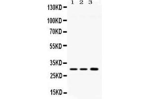Western blot analysis of AQP11 expression in rat brain extract ( Lane 1), mouse brain extract ( Lane 2) and HELA whole cell lysates ( Lane 3). (AQP11 anticorps  (N-Term))