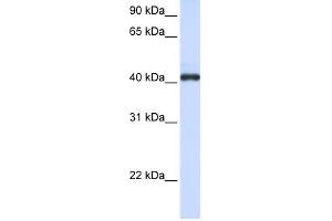 FCRLA antibody used at 1 ug/ml to detect target protein. (FCRLA anticorps  (C-Term))