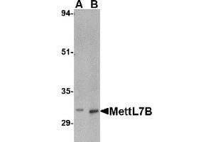 Western Blotting (WB) image for anti-Methyltransferase Like 7B (METTL7B) (C-Term) antibody (ABIN1030517) (METTL7B anticorps  (C-Term))
