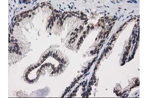 Image no. 2 for anti-Protein Kinase C, epsilon (PRKCE) antibody (ABIN1500228)