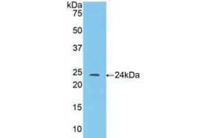 Western blot analysis of recombinant Mouse ANGPT1. (Angiopoietin 1 anticorps  (AA 35-231))