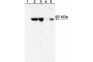 Western blot analysis of T-bet expressed by Mouse Th1 and Th2 cells and Human NK cell and T cell leukemia lines and Peripheral Blood Mononuclear Cells (PBMC). (T-Bet anticorps)