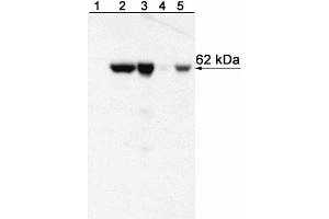 Western blot analysis of T-bet expressed by Mouse Th1 and Th2 cells and Human NK cell and T cell leukemia lines and Peripheral Blood Mononuclear Cells (PBMC).