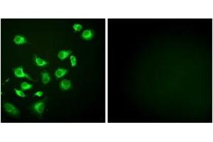 Immunofluorescence analysis of HepG2 cells, using GRP94 Antibody. (GRP94 anticorps  (AA 754-803))