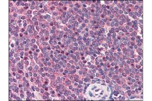 Human Spleen (formalin-fixed, paraffin-embedded) stained with CARD11at 2 µg/ml followed by biotinylated anti-goat IgG secondary antibody, alkaline phosphatase-streptavidin and chromogen. (CARD11 anticorps  (C-Term))