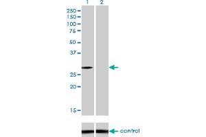 Western blot analysis of NQO1 over-expressed 293 cell line, cotransfected with NQO1 Validated Chimera RNAi (Lane 2) or non-transfected control (Lane 1).