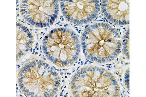 Immunohistochemistry of paraffin-embedded Human rectum using SERPINB5 Polyclonal Antibody at dilution of 1:200 (40x lens).