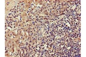 Immunohistochemistry of paraffin-embedded human tonsil tissue using ABIN7165618 at dilution of 1:100 (C22orf13 anticorps  (AA 1-136))