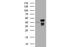 Image no. 1 for anti-Chromobox Homolog 8 (CBX8) (AA 1-260) antibody (ABIN1490666) (CBX8 anticorps  (AA 1-260))