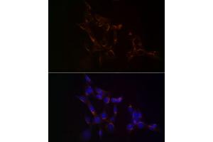 Immunofluorescence analysis of NIH/3T3 cells using USO1 Rabbit mAb (ABIN7271234) at dilution of 1:100 (40x lens). (USO1 anticorps)