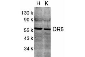 Western Blotting (WB) image for anti-Tumor Necrosis Factor Receptor Superfamily, Member 10b (TNFRSF10B) (C-Term) antibody (ABIN1030367) (TNFRSF10B anticorps  (C-Term))