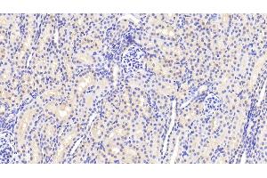Detection of ANXA3 in Human Kidney Tissue using Polyclonal Antibody to Annexin A3 (ANXA3)