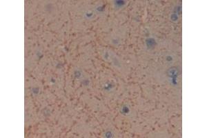 Used in DAB staining on fromalin fixed paraffin- embedded Kidney tissue (ITSN1 anticorps  (AA 1-227))