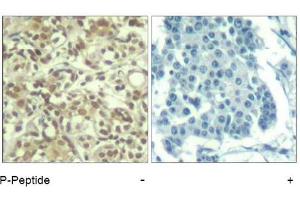 Image no. 1 for anti-V-Akt Murine Thymoma Viral Oncogene Homolog 1 (AKT1) (pThr450) antibody (ABIN319271) (AKT1 anticorps  (pThr450))