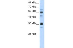 Western Blotting (WB) image for anti-RNA Pseudouridylate Synthase Domain Containing 2 (RPUSD2) antibody (ABIN2462340) (RPUSD2 anticorps)