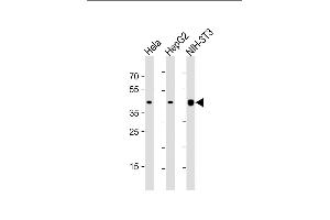 All lanes : Anti-ACTB Antibody at 1:1000 dilution Lane 1: Hela whole cell lysate Lane 2: HepG2 whole cell lysate Lane 3: NIH-3T3 whole cell lysate Lysates/proteins at 20 μg per lane.