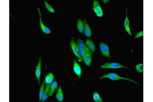 Immunofluorescent analysis of Hela cells using ABIN7159469 at dilution of 1:100 and Alexa Fluor 488-congugated AffiniPure Goat Anti-Rabbit IgG(H+L)