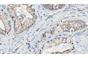 ABIN6277747 at 1/100 staining Human prostate tissue by IHC-P. (IRS2 anticorps  (C-Term))
