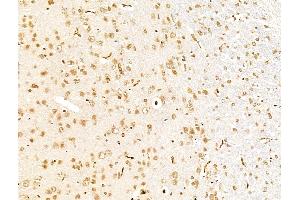 anti-pi-3-Kinase-Related Kinase SMG-1 (SMG1) (C-Term) antibody
