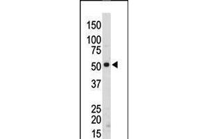 Antibody is used in Western blot to detect SRMS in mouse kidney tissue lysate.