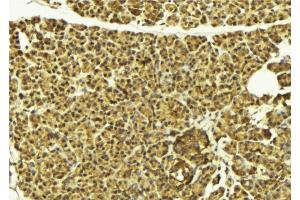 ABIN6269396 at 1/100 staining Mouse pancreas tissue by IHC-P. (HDAC8 anticorps  (N-Term))