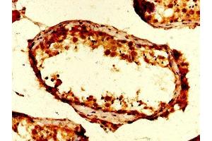 IHC image of ABIN7174409 diluted at 1:200 and staining in paraffin-embedded human testis tissue performed on a Leica BondTM system.