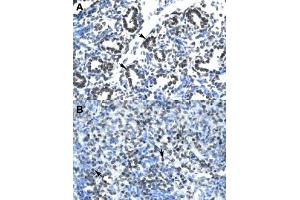 Immunohistochemical staining (Formalin-fixed paraffin-embedded sections) of human lung (A) and human spleen (B) with CLDN17 polyclonal antibody  at 4-8 ug/mL working concentration. (Claudin 17 anticorps  (Internal Region))