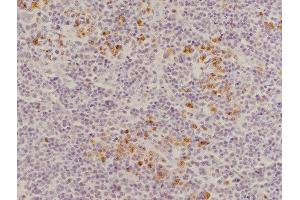 Immunohistochemistry (Paraffin-embedded Sections) (IHC (p)) image for anti-CD8 (CD8) (AA 51-150) antibody (ABIN671391)