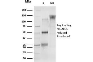 SDS-PAGE Analysis Purified CELF2 Mouse Monoclonal Antibody (PCRP-CELF2-1E4) Confirmation of Purity and Integrity of Antibody. (CELF2 anticorps)