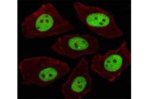 Immunofluorescent analysis of A549 cells using LIN28A antibody at 1:100.