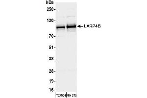 Western Blotting (WB) image for anti-La Ribonucleoprotein Domain Family, Member 4B (LARP4B) (AA 600-650) antibody (ABIN7450405)