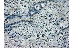 Image no. 3 for anti-Signal Transducer and Activator of Transcription 1, 91kDa (STAT1) antibody (ABIN1501168) (STAT1 anticorps)