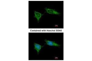 ICC/IF Image Immunofluorescence analysis of methanol-fixed HeLa, using NDUFB5, antibody at 1:200 dilution.
