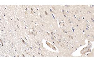 Detection of IL19 in Human Cerebrum Tissue using Monoclonal Antibody to Interleukin 19 (IL19) (IL-19 anticorps  (AA 25-177))