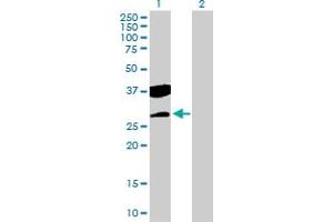 Western Blot analysis of CTDSP2 expression in transfected 293T cell line by CTDSP2 MaxPab polyclonal antibody. (CTDSP2 anticorps  (AA 1-271))