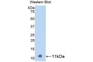 Western Blotting (WB) image for anti-Parathyroid Hormone (PTH) (AA 31-115) antibody (ABIN1078421) (PTH anticorps  (AA 31-115))