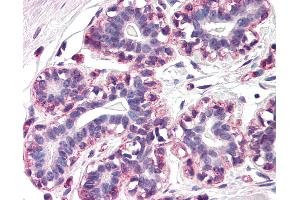 Anti-RAMP3 antibody IHC of human breast. (RAMP3 anticorps  (N-Term))