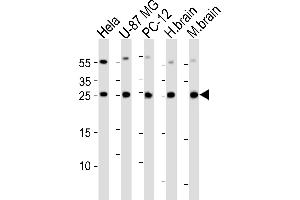 Western blot analysis of lysates from Hela, U-87 MG, rat PC-12 cell line , huamn brain and mouse brain tissue lysate(from left to right), using RAB35 Antibody (C-term) (ABIN6244138 and ABIN6577420). (RAB35 anticorps  (C-Term))