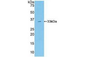 Detection of Recombinant Grb7, Human using Polyclonal Antibody to Growth Factor Receptor Bound Protein 7 (Grb7)