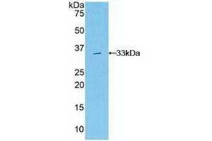 Detection of Recombinant Grb7, Human using Polyclonal Antibody to Growth Factor Receptor Bound Protein 7 (Grb7) (GRB7 anticorps  (AA 66-327))