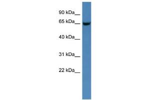 WB Suggested Anti-Gns Antibody Titration: 0. (GNS anticorps  (C-Term))