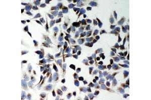ICC: p62 antibody testing of HeLa cells