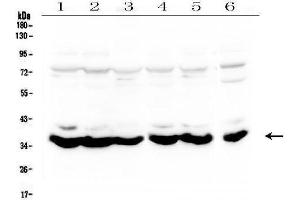 anti-Mitochondrially Encoded NADH Dehydrogenase 4 (MT-ND4) (AA 10-459) antibody